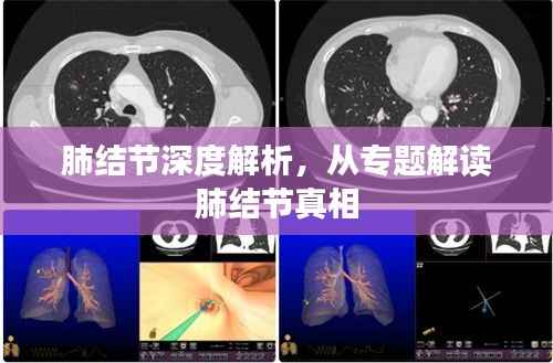 肺结节深度解析,从专题解读肺结节真相