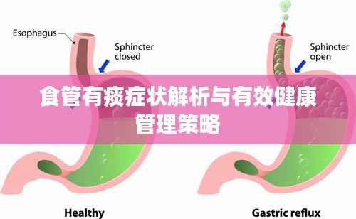 食管有痰症状解析与有效健康管理策略