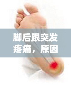 脚后跟突发疼痛，原因解析、诊断指南与治疗方案